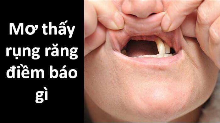 Mộng mơ thấy người khác bị rụng răng